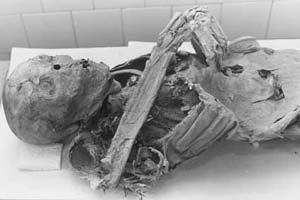 Múmia natural encontrada no Brasil (acervo Fiocruz)