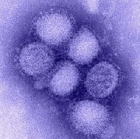 Vírus H1N1. Imagem: Fiocruz.