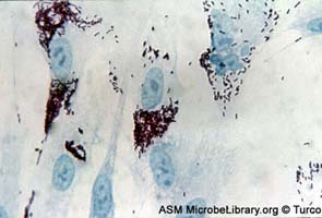 Células humanas infectadas por rickettsias
