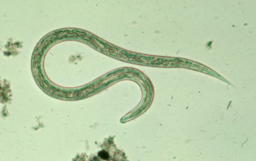 Esta é uma larva que causa o amarelão, vista ao microscópio de luz . Ela mede cerca de 0,5 mm de comprimento. Dentro do corpo humano, o verme fica mais de 20 vezes maior e pode chegar a 1,3 cm.Fonte:www.cdc.gov