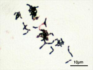 Bifidobacterium adolescentis. Elementos em formato de bastonete nas cores azul escuro, verde escuro e rosa em fundo branco. Imagem obtida por microscopia. Crédito: Y tambe/Wikimedia Commons. 