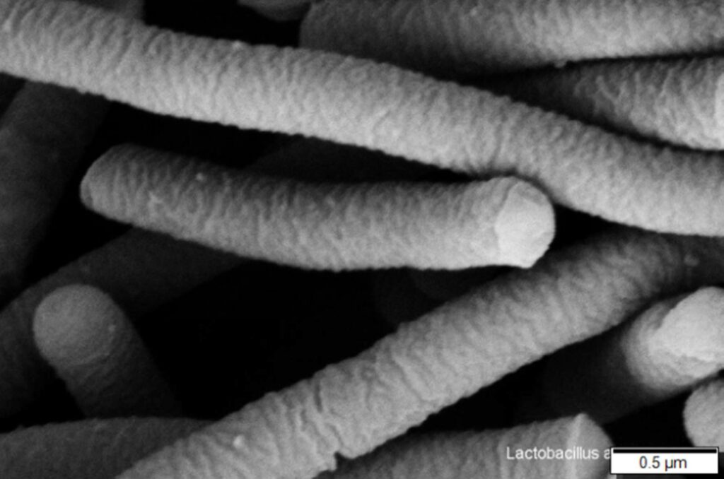 Lactobacillus acidophilus. Elementos em formato de bastão em fundo preto. Imagem em preto e branco obtida por microscópio.