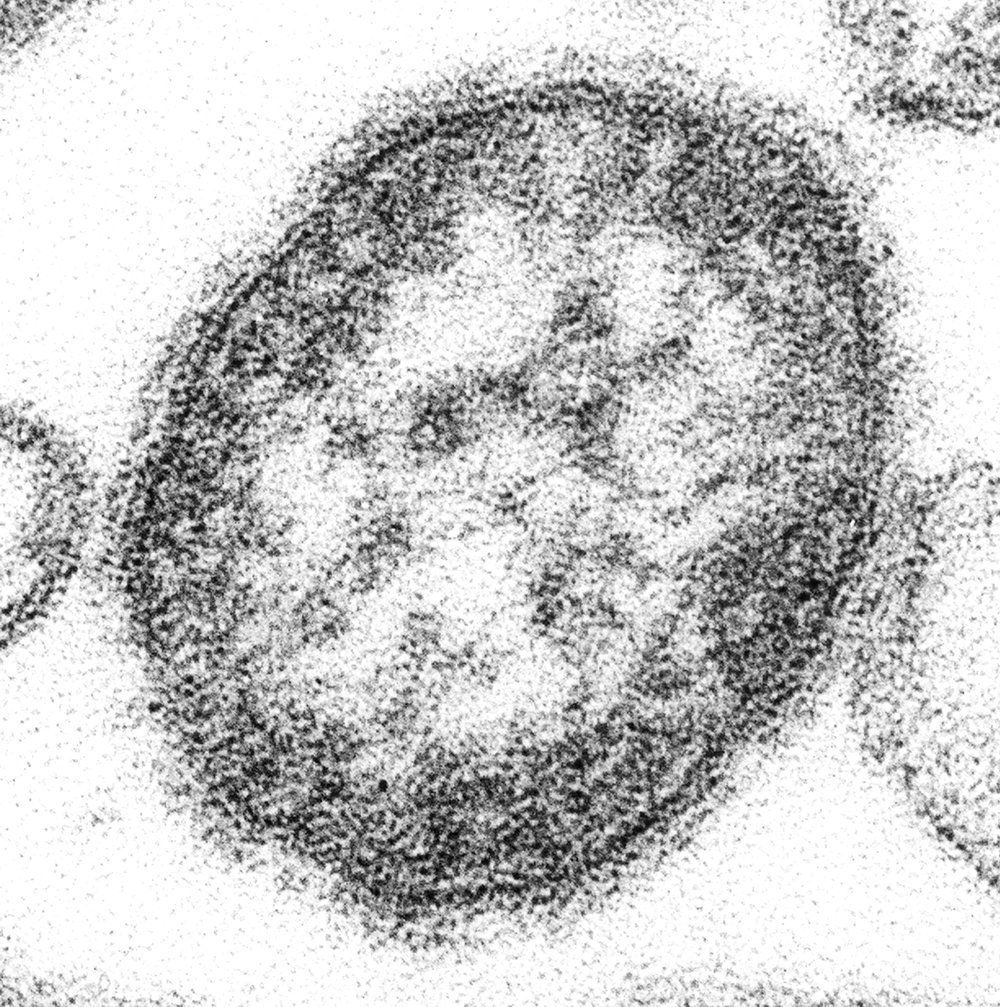 Fotografia em microscopia preto e branco registra vírus do sarampo com forma oval. Crédito: Cynthia S. Goldsmith, William Bellini/Pixnio