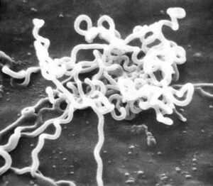 Bactéria Treponema pallidum causadora da sífilis. A imagem foi obtida por microscopia eletrônica. Crédito: domínio público/Picryl