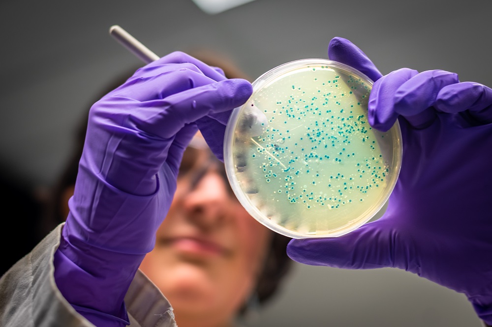 Mulher cientista segura placa com amostra de bactérias com coloração esverdeada. Ela possui pele branca, cabelos curtos e usar luvas roxas de plástico.